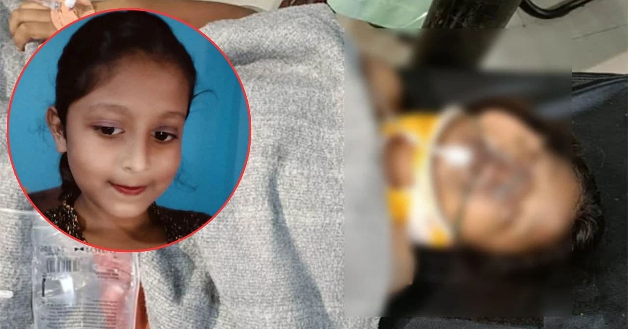 Thumbnail for জীবন-মৃত্যুর সন্ধিক্ষণে হুজাইফা: খুলির অংশ খুলে রেখেই আনা হচ্ছে ঢাকায়